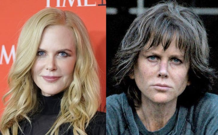 Did Nicole Kidman Have Plastic Surgery?